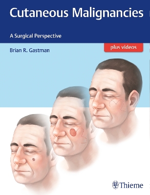 Cutaneous Malignancies: A Surgical Perspective New edition