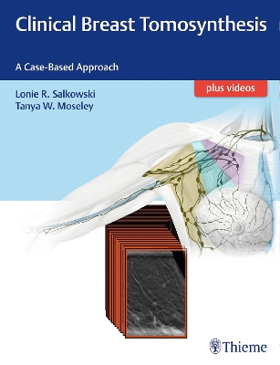 Clinical Breast Tomosynthesis: A Case-Based Approach New edition