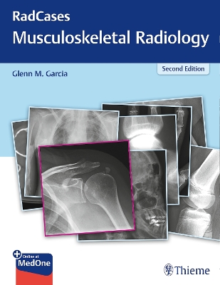 RadCases Q&a Musculoskeletal Radiology 2nd New edition