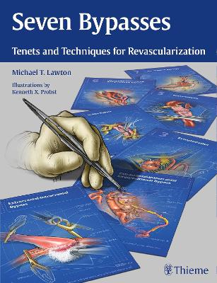 Seven Bypasses: Tenets and Techniques for Revascularization New edition