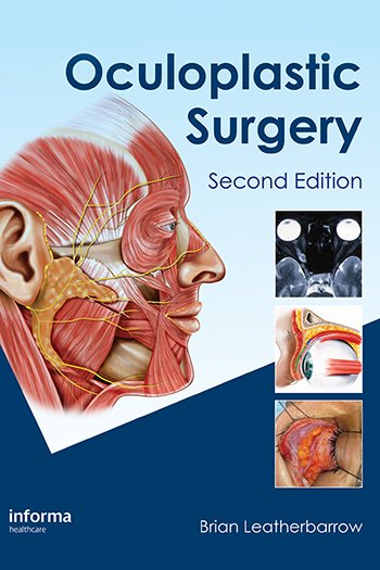 Oculoplastic Surgery 2nd Revised edition