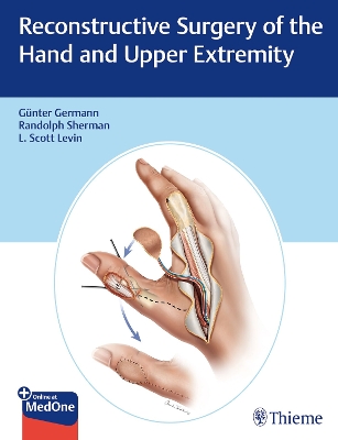 Reconstructive Surgery of the Hand and Upper Extremity New edition