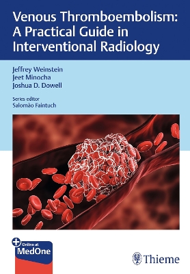Venous Thromboembolism: A Practical Guide in Interventional Radiology New edition