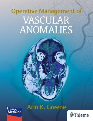 Operative Management of Vascular Anomalies New edition