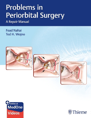 Problems in Periorbital Surgery: A Repair Manual New edition