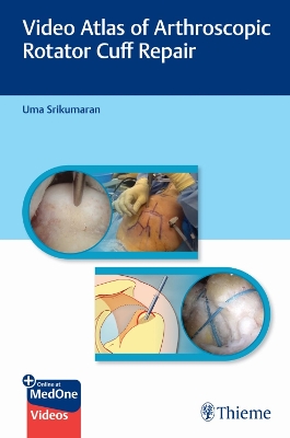 Video Atlas of Arthroscopic Rotator Cuff Repair New edition