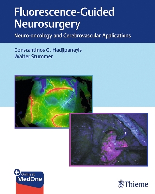 Fluorescence-Guided Neurosurgery: Neuro-oncology and Cerebrovascular Applications New edition
