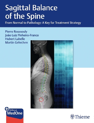 Sagittal Balance of the Spine: From Normal to Pathology: a Key for Treatment Strategy New edition