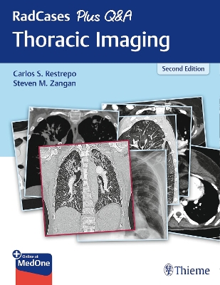 RadCases Plus Q&a Thoracic Imaging 2nd New edition