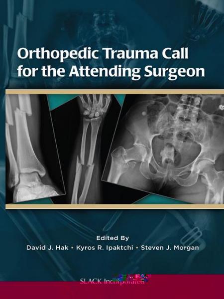 Orthopedic Trauma Call for the Attending Surgeon
