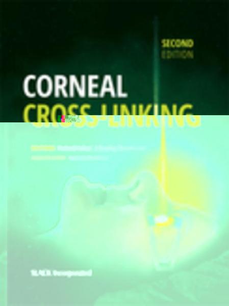 Corneal Cross-Linking, Second Edition