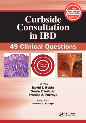Curbside Consultation in IBD: 49 Clinical Questions 3rd edition