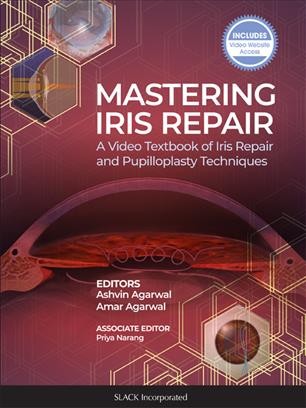 Mastering Iris Repair: A Video Textbook of Iris Repair and Pupilloplasty Techniques