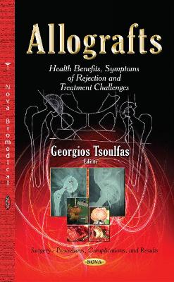 Allografts: Health Benefits, Symptoms of Rejection and Treatment Challenges