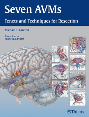 Seven AVMs: Tenets and Techniques for Resection