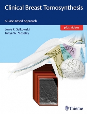 Clinical Breast Tomosynthesis: A Case-Based Approach