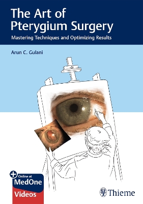 Art of Pterygium Surgery: Mastering Techniques and Optimizing Results
