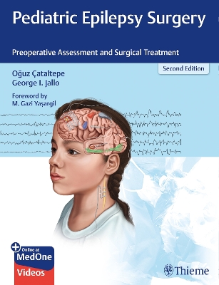 Pediatric Epilepsy Surgery: Preoperative Assessment and Surgical Treatment