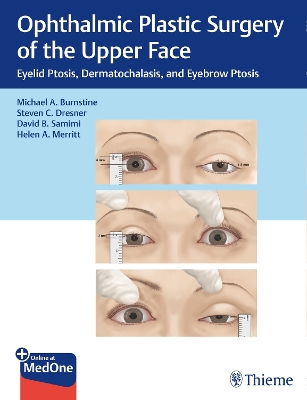 Ophthalmic Plastic Surgery of the Upper Face: Eyelid Ptosis, Dermatochalasis, and Eyebrow Ptosis