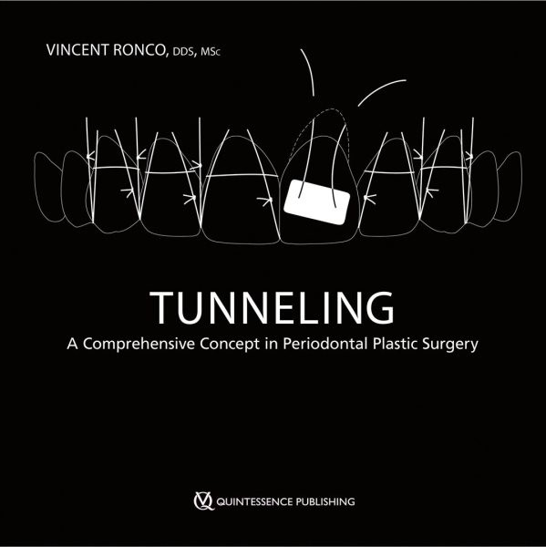 Tunneling: A Comprehensive Concept in Periodontal Plastic Surgery