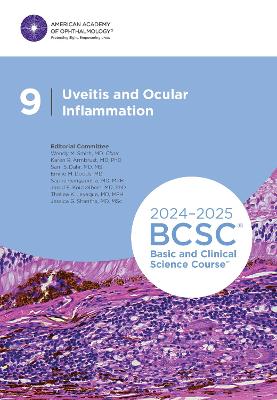2024-2025 Basic and Clinical Science Course, Section 9: Uveitis and Ocular Inflammation