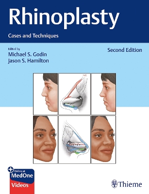 Rhinoplasty: Cases and Techniques 2nd New edition