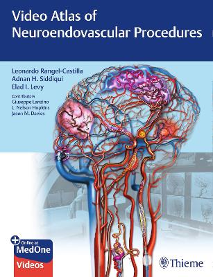 Video Atlas of Neuroendovascular Procedures New edition