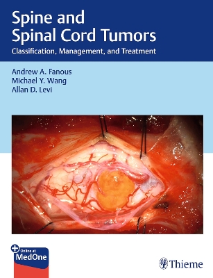 Spine and Spinal Cord Tumors: Classification, Management, and Treatment New edition