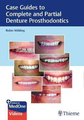 Case Guides to Complete and Partial Denture Prosthodontics New edition