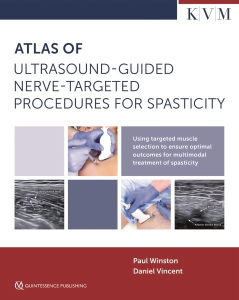 Atlas of Ultrasound-Guided Nerve-Targeted Procedures for Spasticity: Using Targeted Muscle Selection to Ensure Optimal Outcomes for Multimodal Treatment of Spasticity