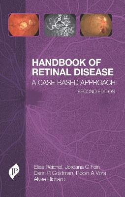 Handbook of Retinal Disease: A Case-Based Approach 2nd Revised edition