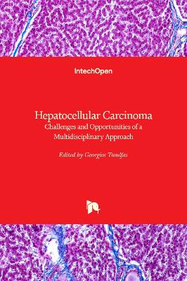 Hepatocellular Carcinoma: Challenges and Opportunities of a Multidisciplinary Approach