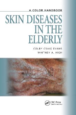 Skin Diseases in the Elderly: A Color Handbook