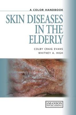 Skin Diseases in the Elderly: A Color Handbook