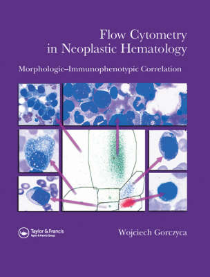 Flow Cytometry in Neoplastic Hematology
