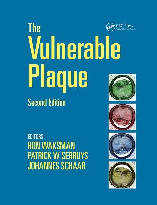 Handbook of the Vulnerable Plaque 2nd edition