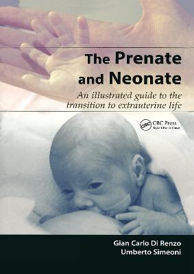 Prenate and Neonate: An Illustrated Guide to the Transition to Extrauterine Life
