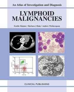 Lymphoid Malignancies, v. 1