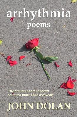 Arrhythmia