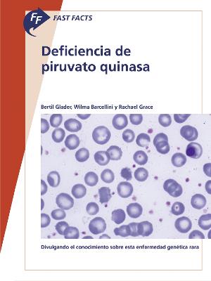 Fast Facts: Deficiencia de piruvato quinasa: Divulgando el conocimiento sobre esta enfermedad genética rara