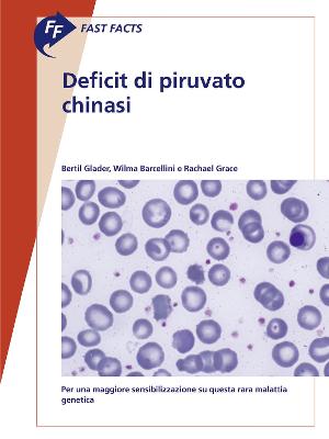 Fast Facts: Deficit di piruvato chinasi: Per una maggiore sensibilizzazione su questa rara malattia genetica