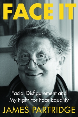 Face It: Facial Disfigurement and My Fight For Face Equality