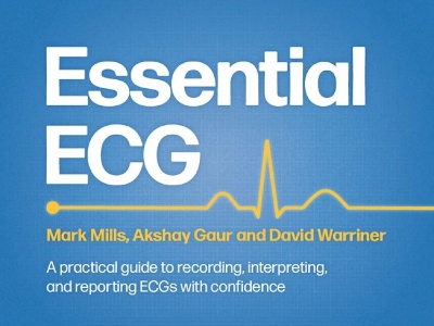 Essential ECG: A practical guide to recording, interpreting, and reporting ECGs with  confidence