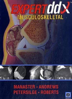 EXPERTddx: Musculoskeletal: Published by Amirsys®