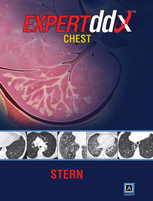 EXPERTddx: Chest: Published by Amirsys®