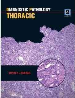 Diagnostic Pathology: Thoracic: Published by Amirsys®