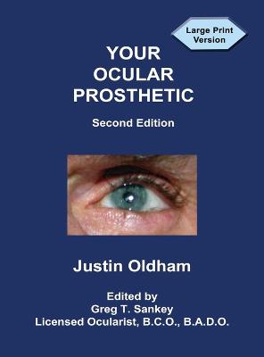 Your Ocular Prosthetic 2nd ed.