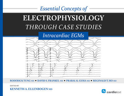 Essential Concepts of Electrophysiology through Case Studies: Intracardiac EGMs: Intracardiac EGMs