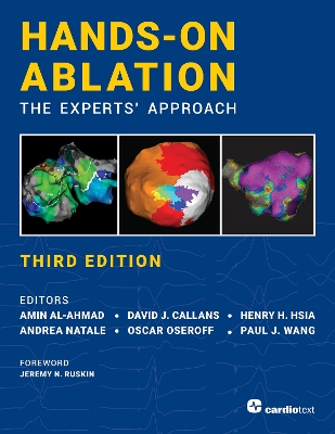 Hands-On Ablation: The Experts' Approach, Third Edition: The Experts' Approach 3rd Enlarged edition