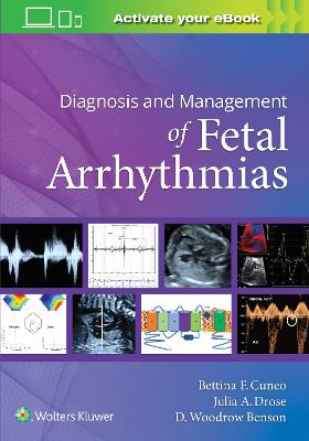 Diagnosis and Management of Fetal Arrhythmias